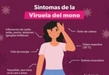 Invita SSM a solicitar información sobre la viruela símica