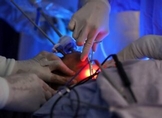 Implementa SSM nueva cirugía para tratar cáncer de tiroides