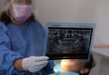 Otorga SSM más 30 mil consultas dentales gratuitas en primer trimestre de 2023
