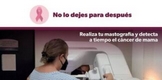 Reporta SSM más de 8 mil mastografías gratuitas durante 2023