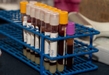 Promueve DIF Michoacán cultura de donación de sangre