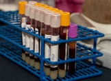 Promueve DIF Michoacán cultura de donación de sangre