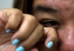 ¿Ojos rojos o picazón? Podría ser conjuntivitis, advierte SSM