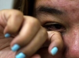 ¿Ojos rojos o picazón? Podría ser conjuntivitis, advierte SSM