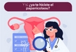 Tiene SSM 7 clínicas para la detección oportuna de cáncer cervicouterino