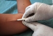 APLICA SSM IMPLANTES SUBDÉRMICOS GRATUITOS PARA PARA PREVENIR EMBARAZOS