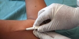 APLICA SSM IMPLANTES SUBDÉRMICOS GRATUITOS PARA PARA PREVENIR EMBARAZOS