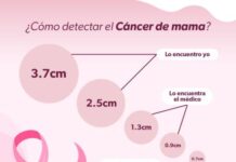 SSM recorre comunidades alejadas para realizar mastografías gratuitas