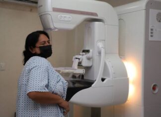 Mastografía, acción prioritaria para detección temprana del cáncer de mama