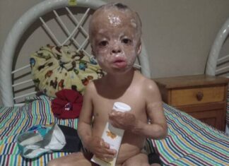 «Un llamado a la esperanza: Chuchito necesita nuestra ayuda»
