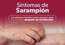 ¿Fiebre y manchas rojas? Podría ser sarampión; conoce los síntomas según la SSM